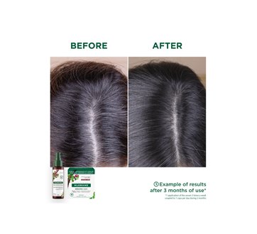 Image 5 of product Klorane - KeratinCaps Strength and vitality for hair & nails, 30 units