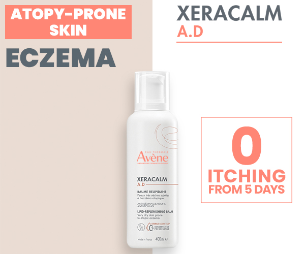 Eczema